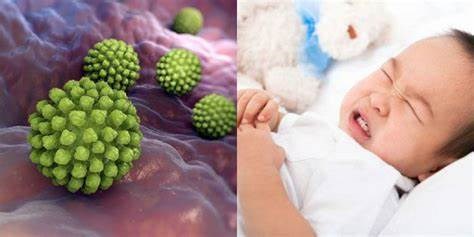 Bệnh tiêu chảy do virus Rota là gì? triệu chứng và cách phòng ngừa